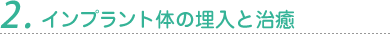2. インプラント体の埋入と治癒